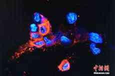 香港大學團隊成功分離及培養(yǎng)奧密克戎變異病毒株